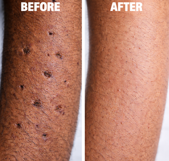 skin